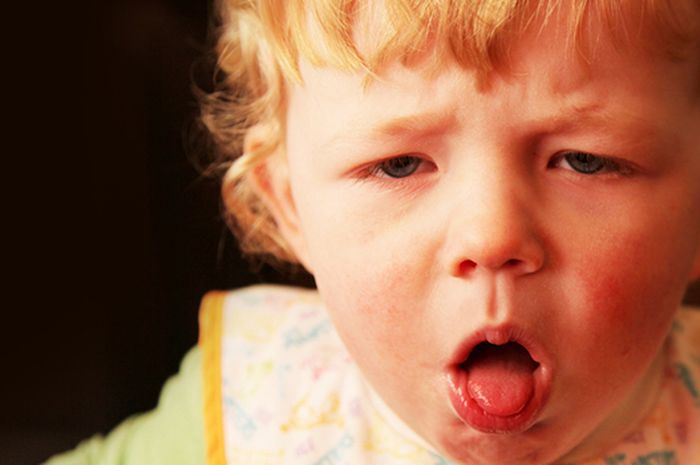 Cara mengobati batuk kering pada anak